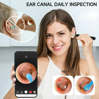 Earwax Remover With Camera